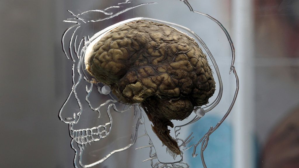 For the first time, a human brain has been continuously scanned throughout the process of dying, and the results suggest our life may really flash before our eyes. Pictured, a real human brain is displayed as part of The Real Brain exhibit on March 8, 2011, in Bristol, England. The exhibit had full consent from an anonymous donor and needed full consent from the Human Tissue Authority. The brain is suspended in large tank engraved with a full scale skeleton on one side and a diagram of the central nervous system on the other. (Matt Cardy/Getty Images)