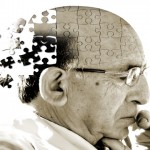 Alzheimer