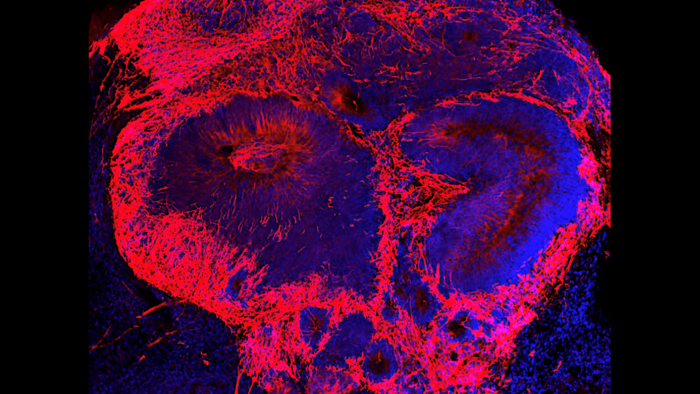 Origins Of Schizophrenia May Be Found In Early Embryonic Development