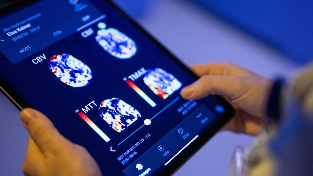 strongA radiologist at Unfallkrankenhaus Berlin looks at a patient's brain images in an AI-based app on a tablet. Artificial intelligence is the answer to the world's soaring healthcare expenses, staff shortages at crisis levels, and exponential expansion in medical data. MONIKA SKOLIMOWSKA/PICTURE ALLIANCE/GETTY IMAGES/strong